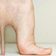 Image for article titled Stiletto implants make your feet look just like Barbie's
